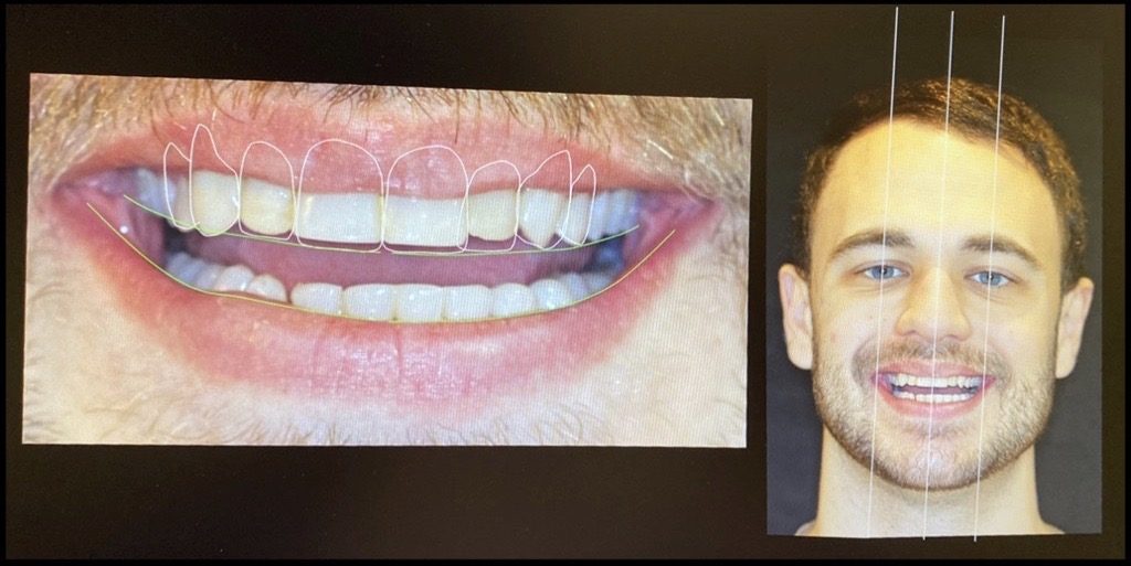 IMG 1491 1024x513 - Tratamento Odontológico na Cury Odontologia com o Dr. Marcio Gulin Cury
