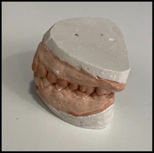 IMG 1491 2 - Tratamento Odontológico na Cury Odontologia com o Dr. Marcio Gulin Cury